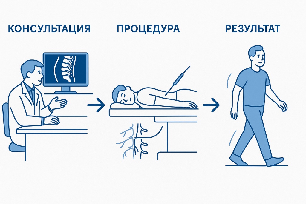 Этапы Радиочастотной Абляции.jpg